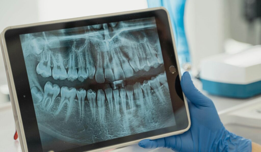 Why X-Rays Are Important in Dentistry